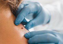 Inadequate and delayed characterization of cutaneous reactions for US Food and Drug Administration-approved oncologic drugs from 2011-2020 leading to medication discontinuation