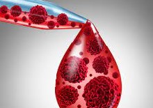 Implications of Research Biopsies in Clinical Trials