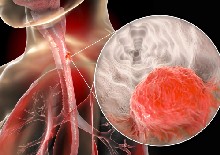 Value assessment of PD-1/PD-L1 inhibitors in the treatment of esophageal and gastrointestinal cancers
