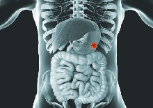 Anticancer drugs approved by the Food and Drug Administration for gastrointestinal malignancies: Clinical benefit and price considerations