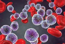The Case for Real-world Evidence in the Future of Clinical Research on Chronic Myeloid Leukemia