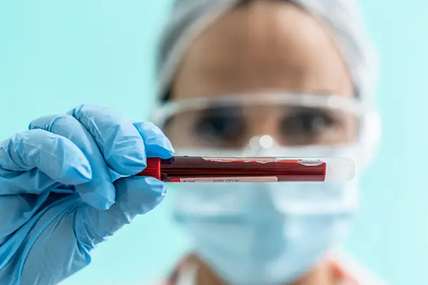 Liquid biopsy in oncology: a consensus statement of the Spanish Society of Pathology and the Spanish Society of Medical Oncology