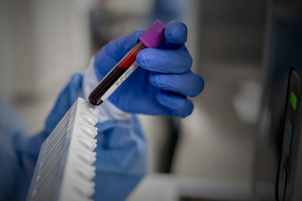 Liquid biopsy in oncology: a consensus statement of the Spanish Society of Pathology and the Spanish Society of Medical Oncology