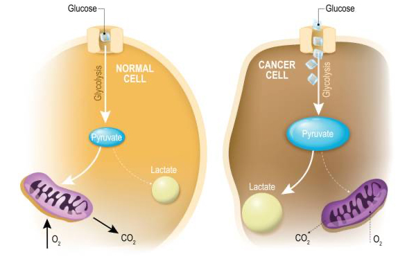 “Oncometabolism: The switchboard of cancer: An editorial”